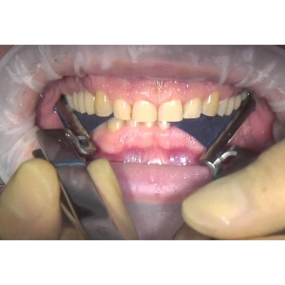 Dental Articulating Paper