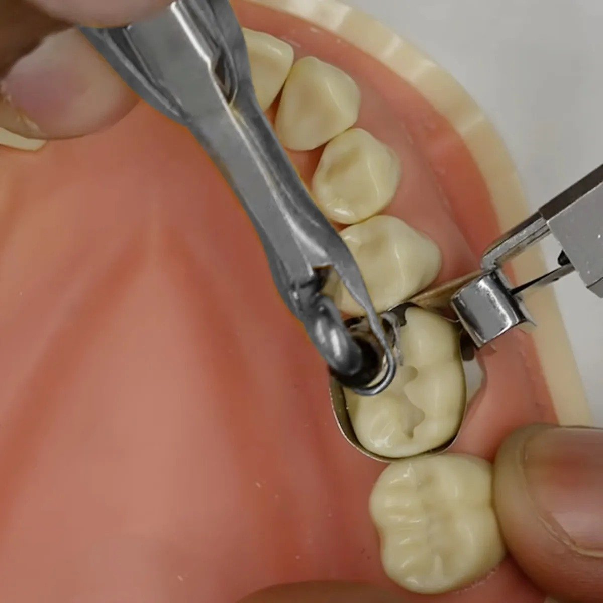Amalgam Carrier