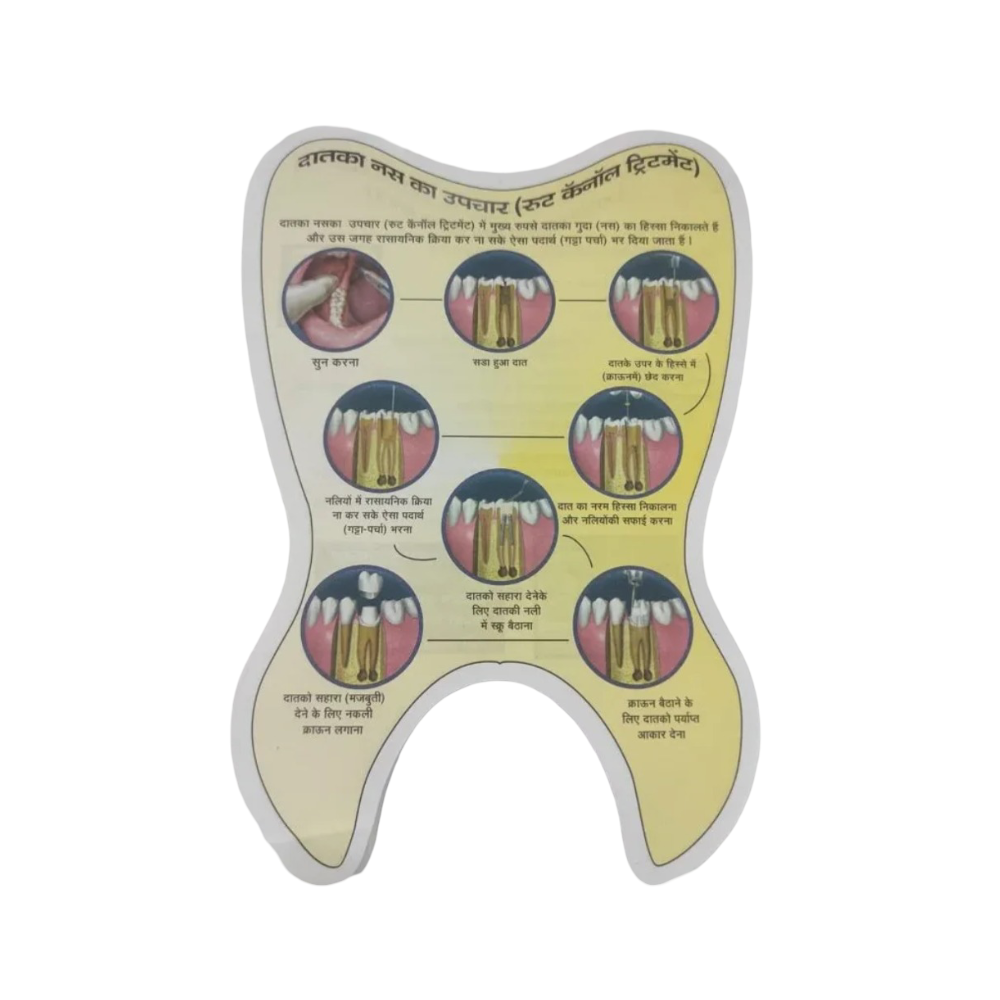 Root Canal Treatment (RCT) Educative Pad - Hindi