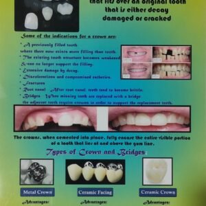 Crown & Bridge – Laminated Poster