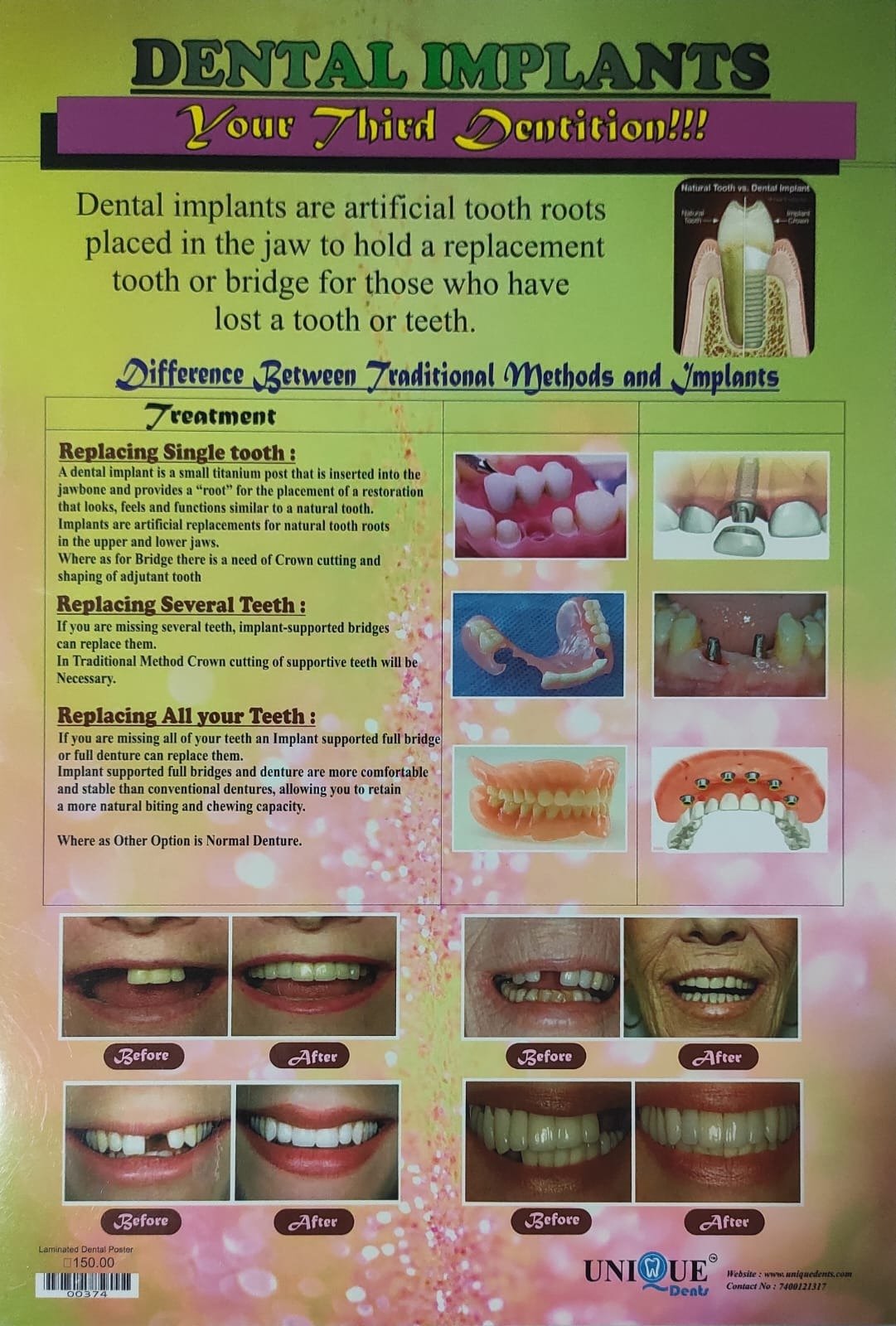 Dental Implant – Laminated Poster