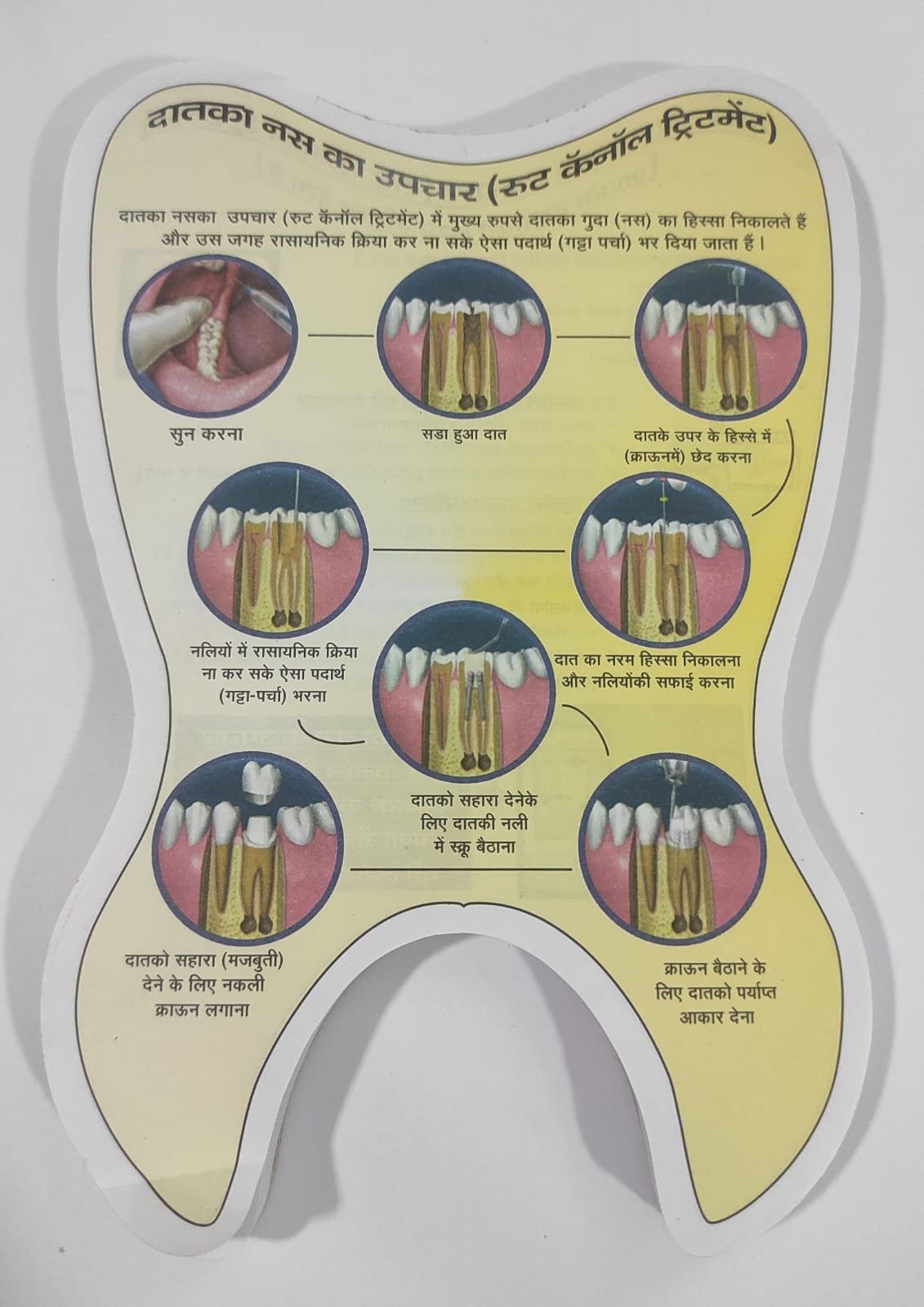 Root Canal Treatment (RCT) Educative Pad - Hindi