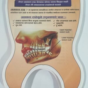 Wisdom Tooth Extraction Educative Pad – Hindi