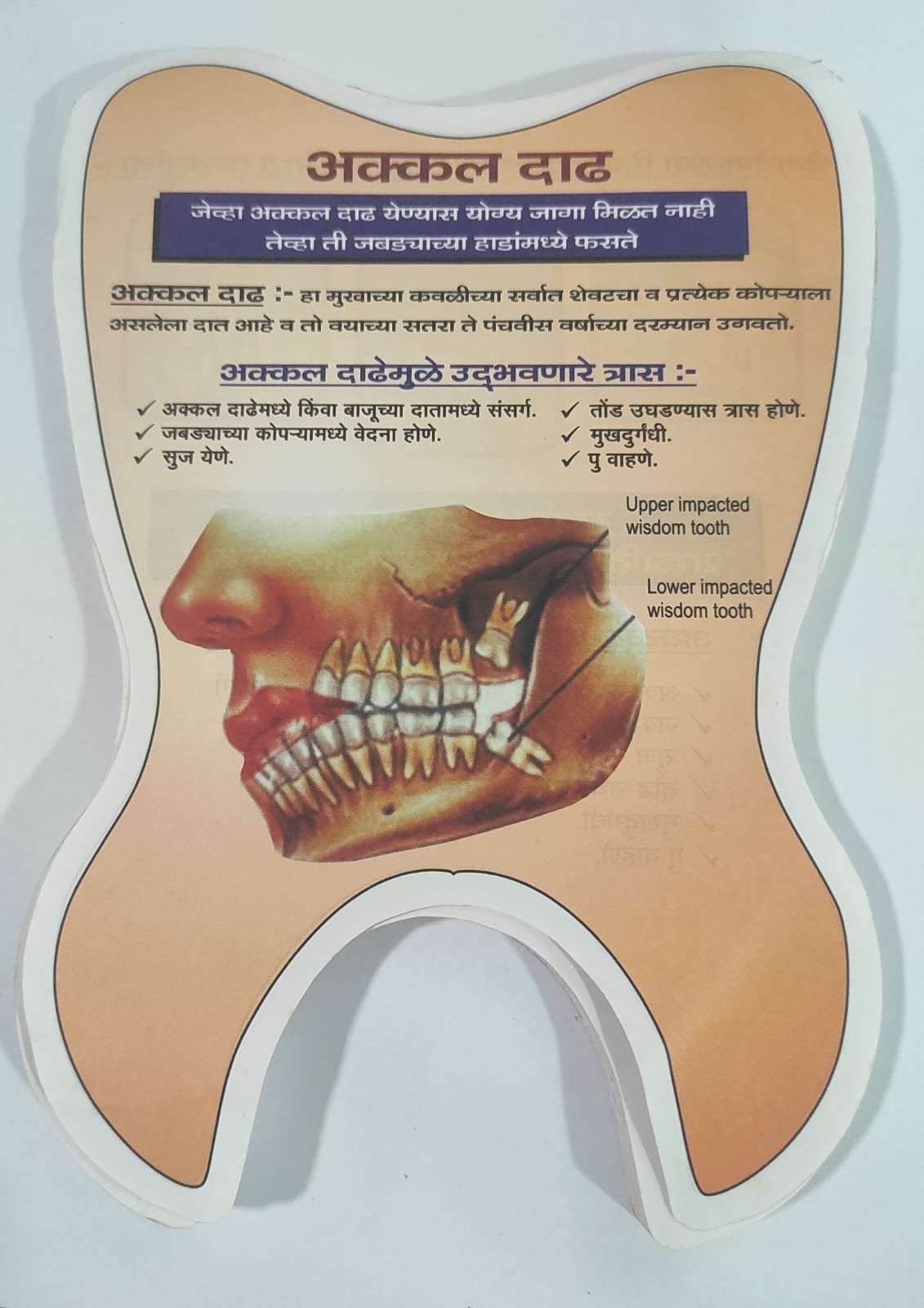 Wisdom Tooth Extraction Educative Pad - Hindi
