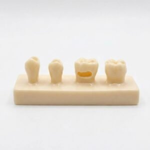 Composite Filling Model – Posterior