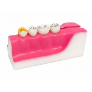 Molar Cross Section Study Model
